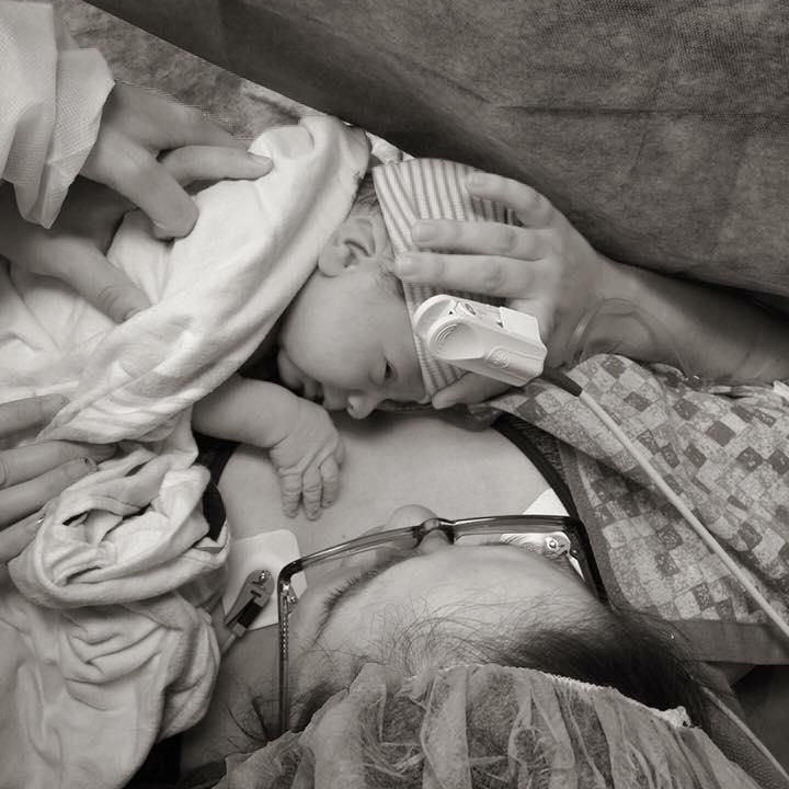 caesarean birth