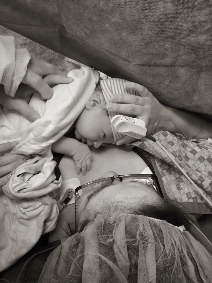 caesarean birth